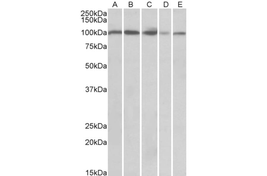 Western Blot - Anti-SIDT1 Antibody (A84990) - Antibodies.com