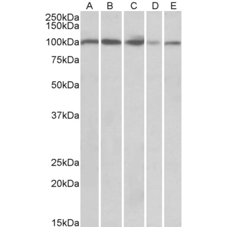 Western Blot - Anti-SIDT1 Antibody (A84990) - Antibodies.com