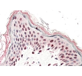 Immunohistochemistry - Anti-SRCAP Antibody (A84991) - Antibodies.com