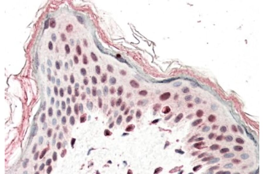 Immunohistochemistry - Anti-SRCAP Antibody (A84991) - Antibodies.com