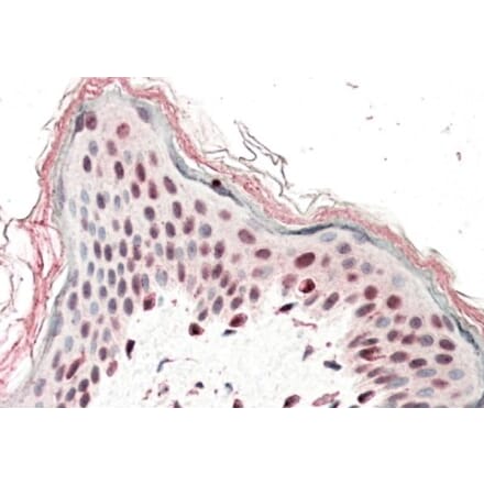 Immunohistochemistry - Anti-SRCAP Antibody (A84991) - Antibodies.com