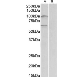 Western Blot - Anti-UNC5B Antibody (A84992) - Antibodies.com