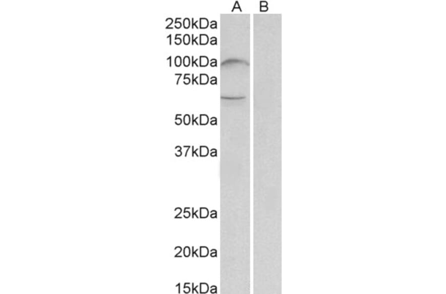 Western Blot - Anti-UNC5B Antibody (A84992) - Antibodies.com