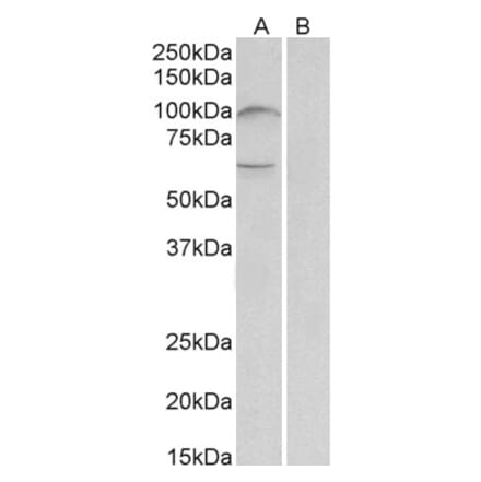 Western Blot - Anti-UNC5B Antibody (A84992) - Antibodies.com