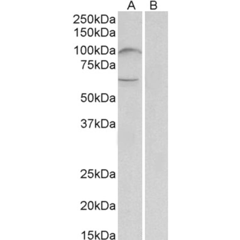 Western Blot - Anti-UNC5B Antibody (A84992) - Antibodies.com