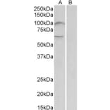 Western Blot - Anti-UNC5B Antibody (A84992) - Antibodies.com