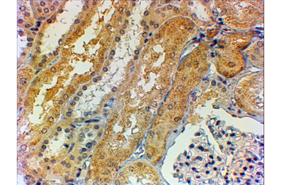 Immunohistochemistry - Anti-Tensin 1 Antibody (A84993) - Antibodies.com