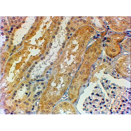 Immunohistochemistry - Anti-Tensin 1 Antibody (A84993) - Antibodies.com