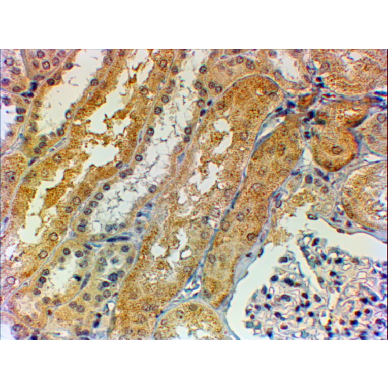 Immunohistochemistry - Anti-Tensin 1 Antibody (A84993) - Antibodies.com