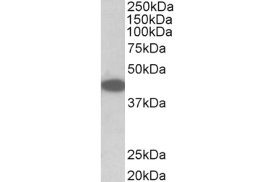 Western Blot - Anti-TRIB1 Antibody (A84995) - Antibodies.com