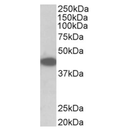 Western Blot - Anti-TRIB1 Antibody (A84995) - Antibodies.com