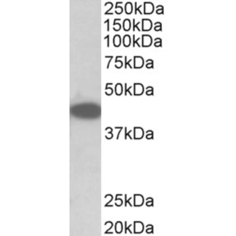 Western Blot - Anti-TRIB1 Antibody (A84995) - Antibodies.com