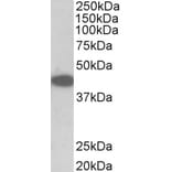 Western Blot - Anti-TRIB1 Antibody (A84995) - Antibodies.com