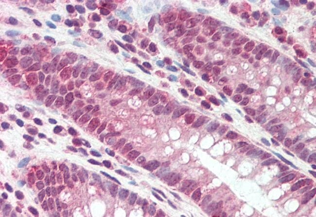 Anti-DEFB107A Antibody (A84996) (5µg/ml) staining of paraffin embedded Human Colon. Steamed antigen retrieval with citrate buffer pH 6, AP-staining.