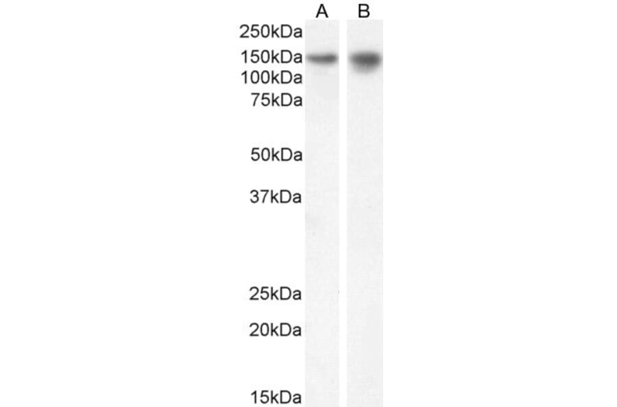 Western Blot - Anti-SynGAP Antibody (A84997) - Antibodies.com