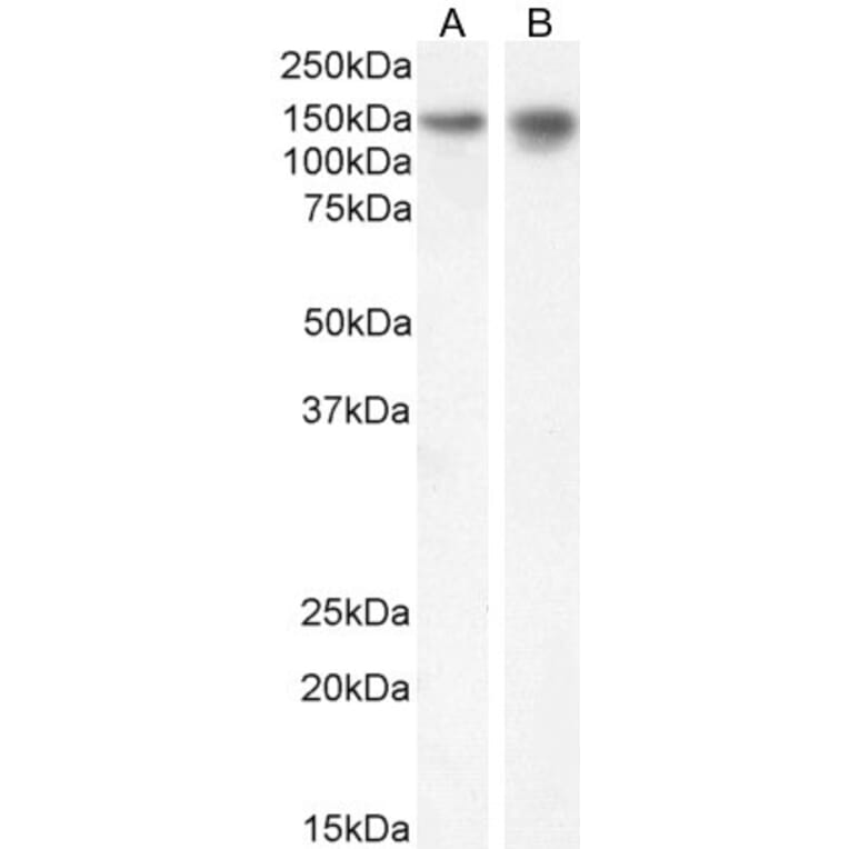Western Blot - Anti-SynGAP Antibody (A84997) - Antibodies.com