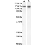 Western Blot - Anti-SynGAP Antibody (A84997) - Antibodies.com