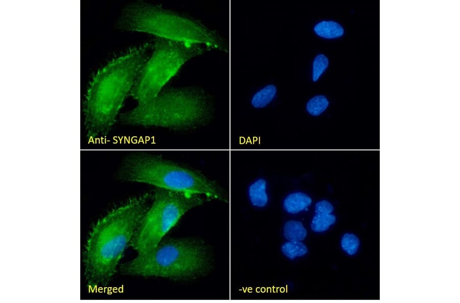 Immunofluorescence - Anti-SynGAP Antibody (A84997) - Antibodies.com
