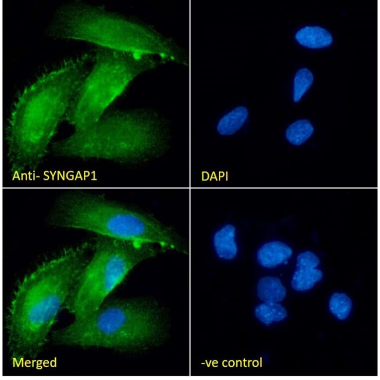 Immunofluorescence - Anti-SynGAP Antibody (A84997) - Antibodies.com