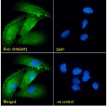 Immunofluorescence - Anti-SynGAP Antibody (A84997) - Antibodies.com