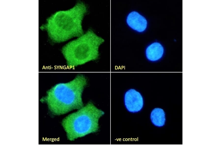 Immunofluorescence - Anti-SynGAP Antibody (A84997) - Antibodies.com