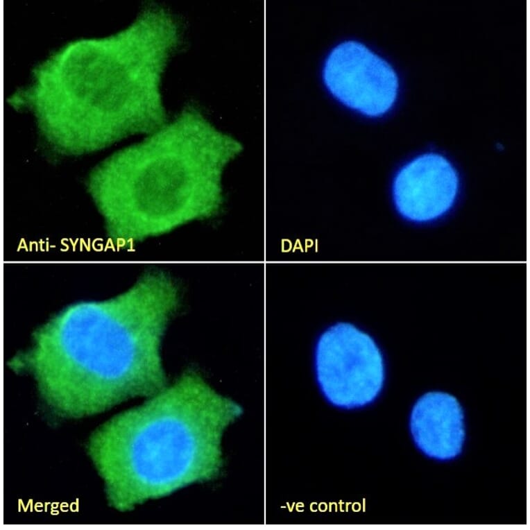 Immunofluorescence - Anti-SynGAP Antibody (A84997) - Antibodies.com