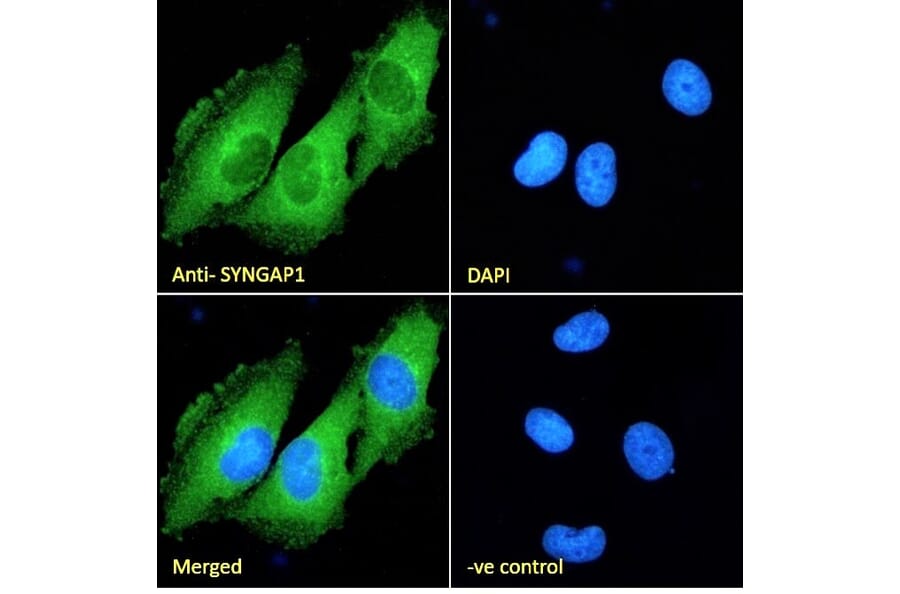 Immunofluorescence - Anti-SynGAP Antibody (A84997) - Antibodies.com