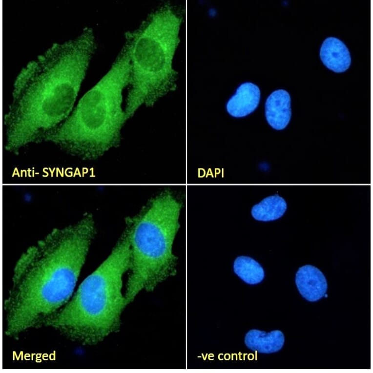 Immunofluorescence - Anti-SynGAP Antibody (A84997) - Antibodies.com