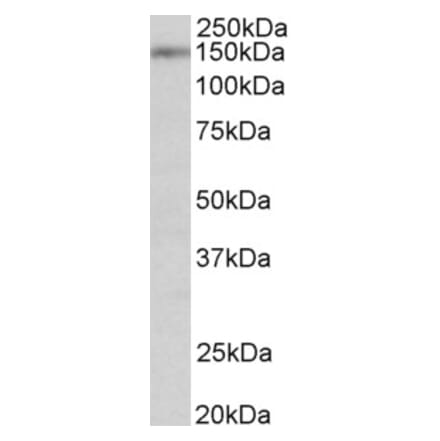 Western Blot - Anti-SynGAP Antibody (A84998) - Antibodies.com