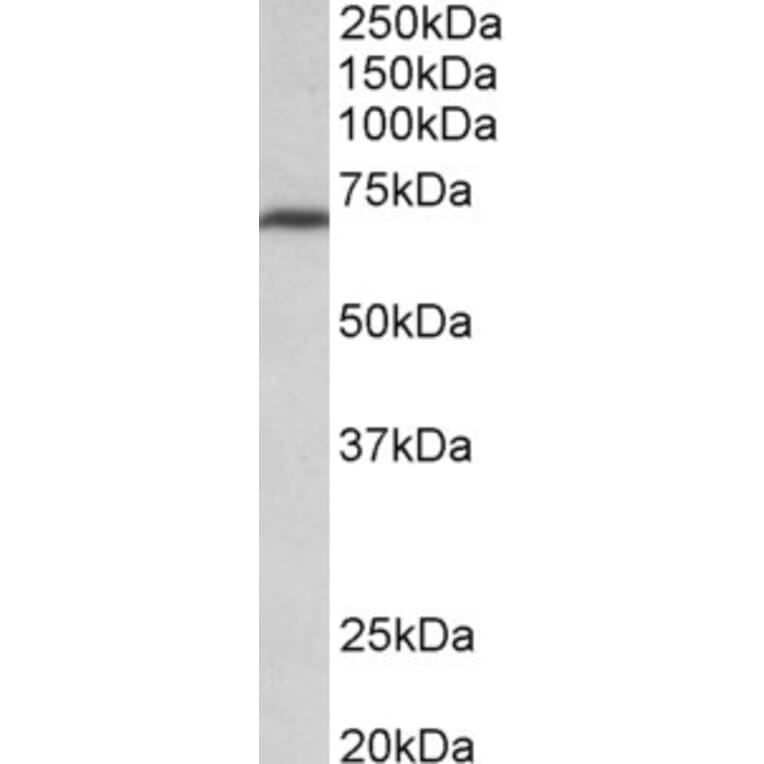 Western Blot - Anti-MTHFR Antibody (A85000) - Antibodies.com