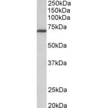 Western Blot - Anti-MTHFR Antibody (A85000) - Antibodies.com