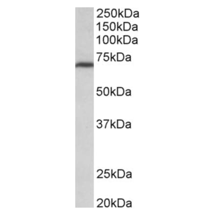 Western Blot - Anti-MTHFR Antibody (A85000) - Antibodies.com