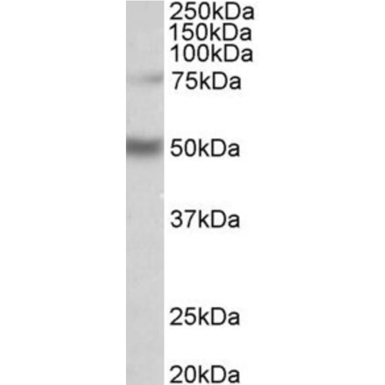 Western Blot - Anti-ULK3 Antibody (A85001) - Antibodies.com