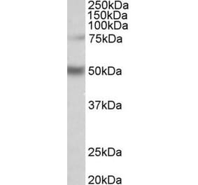 Western Blot - Anti-ULK3 Antibody (A85001) - Antibodies.com