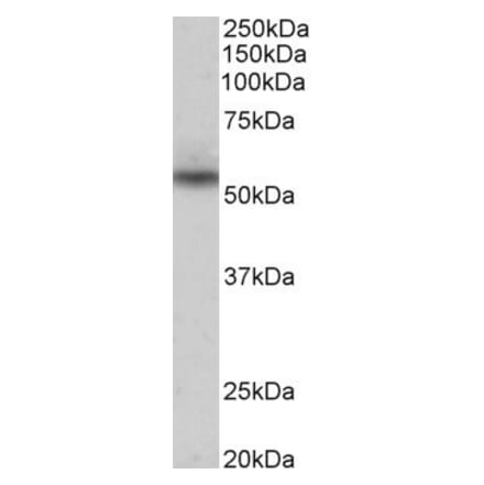 Western Blot - Anti-NPRL3 Antibody (A85003) - Antibodies.com