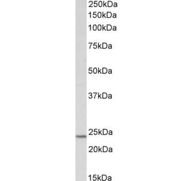 Western Blot - Anti-TIMP1 Antibody (A85005) - Antibodies.com