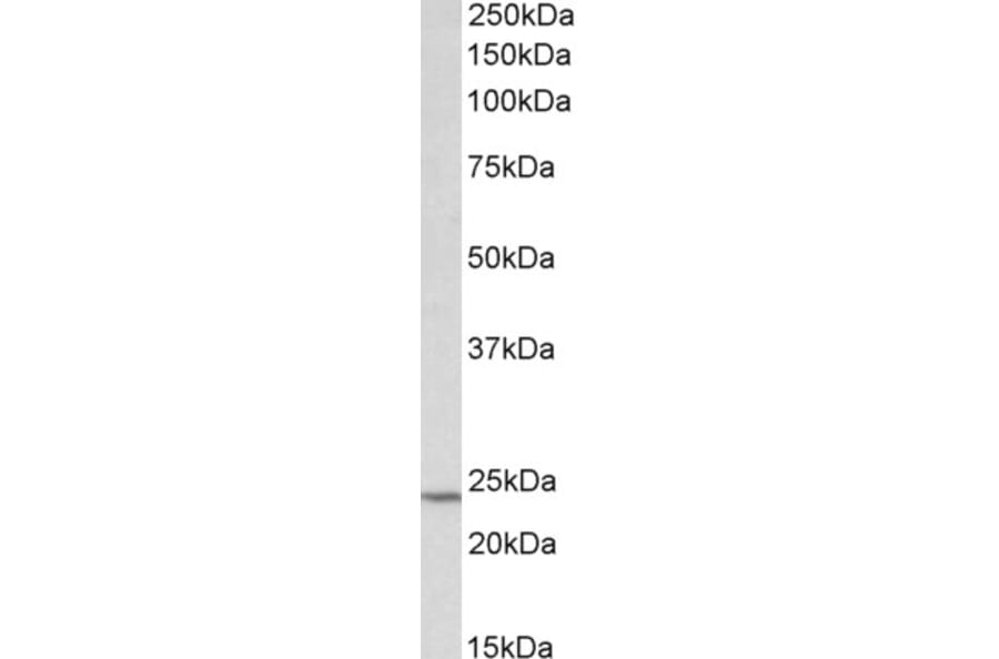 Western Blot - Anti-TIMP1 Antibody (A85005) - Antibodies.com