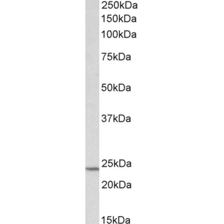 Western Blot - Anti-TIMP1 Antibody (A85005) - Antibodies.com