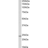 Western Blot - Anti-TIMP1 Antibody (A85005) - Antibodies.com