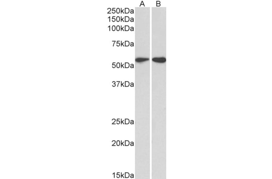 Western Blot - Anti-Vimentin Antibody (A85007) - Antibodies.com