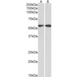 Western Blot - Anti-Vimentin Antibody (A85007) - Antibodies.com