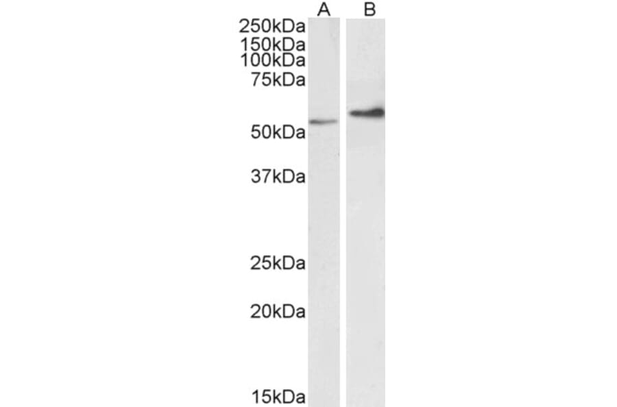 Western Blot - Anti-Vimentin Antibody (A85007) - Antibodies.com