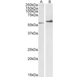 Western Blot - Anti-Vimentin Antibody (A85007) - Antibodies.com