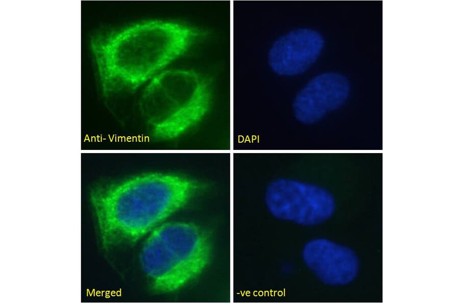 Immunofluorescence - Anti-Vimentin Antibody (A85007) - Antibodies.com