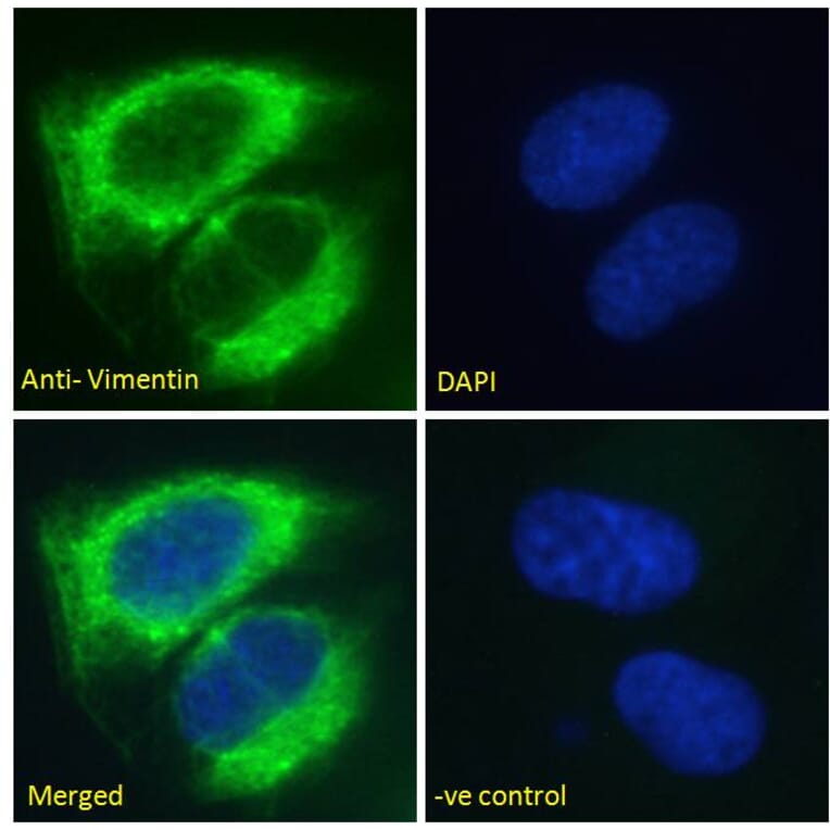 Immunofluorescence - Anti-Vimentin Antibody (A85007) - Antibodies.com
