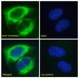 Immunofluorescence - Anti-Vimentin Antibody (A85007) - Antibodies.com