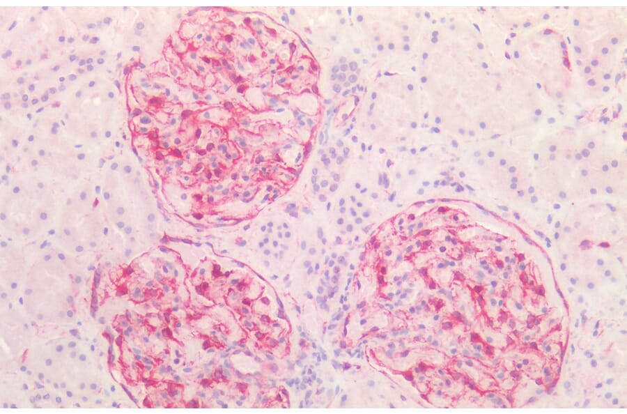 Immunohistochemistry - Anti-Vimentin Antibody (A85007) - Antibodies.com