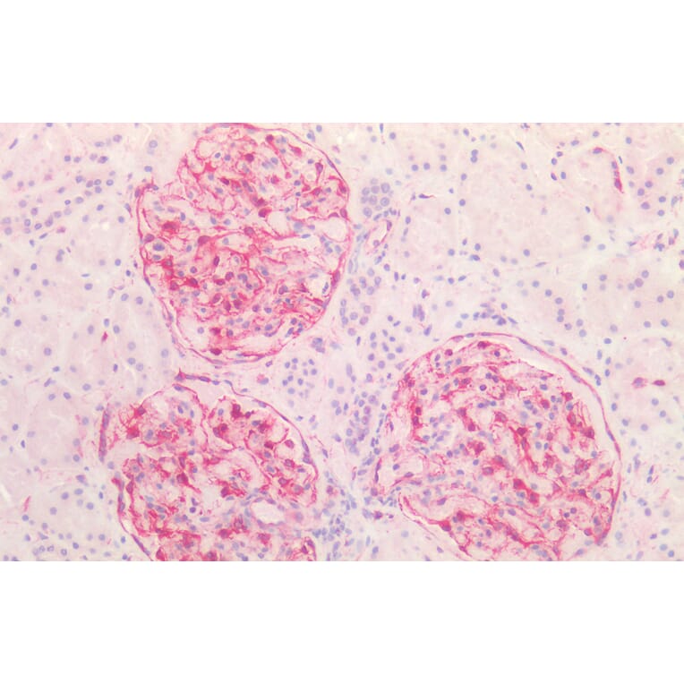 Immunohistochemistry - Anti-Vimentin Antibody (A85007) - Antibodies.com
