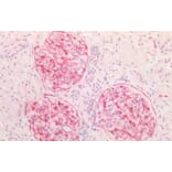 Immunohistochemistry - Anti-Vimentin Antibody (A85007) - Antibodies.com