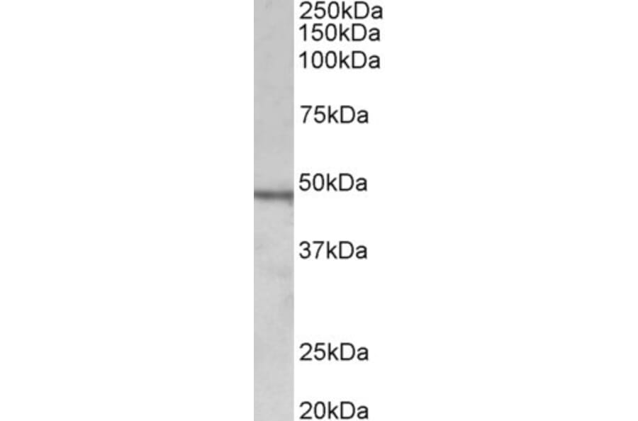 Western Blot - Anti-CHIT1 Antibody (A85008) - Antibodies.com